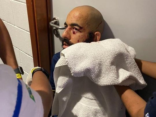 У&nbsp;Бразилії в&nbsp;автобусі з&nbsp;футболістами вибухнула бомба: є&nbsp;поранені