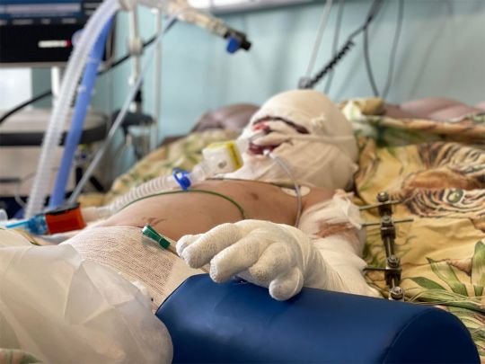 Поки що жодного разу не приходив до тями: у Німеччині рятують 7-річного хлопчика, який постраждав від ударів окупантів по Вінниці